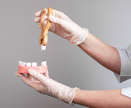 a dentist demonstrating wisdom tooth extraction on a model