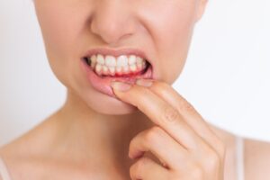 person with gum disease
